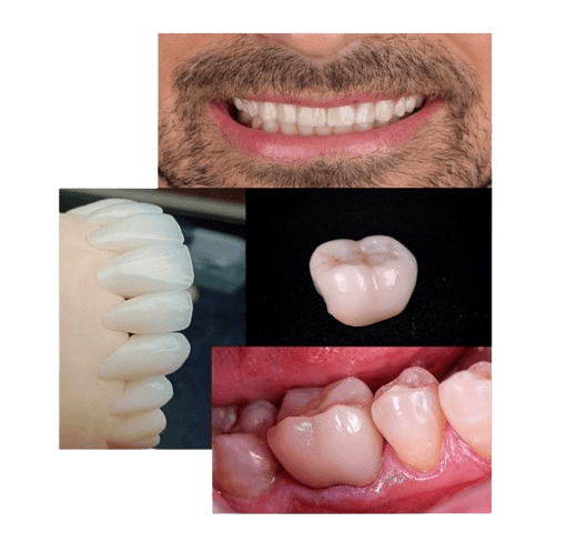 <img source='pic.gif' alt='soluções personalizadas em prótese para clínicas' />